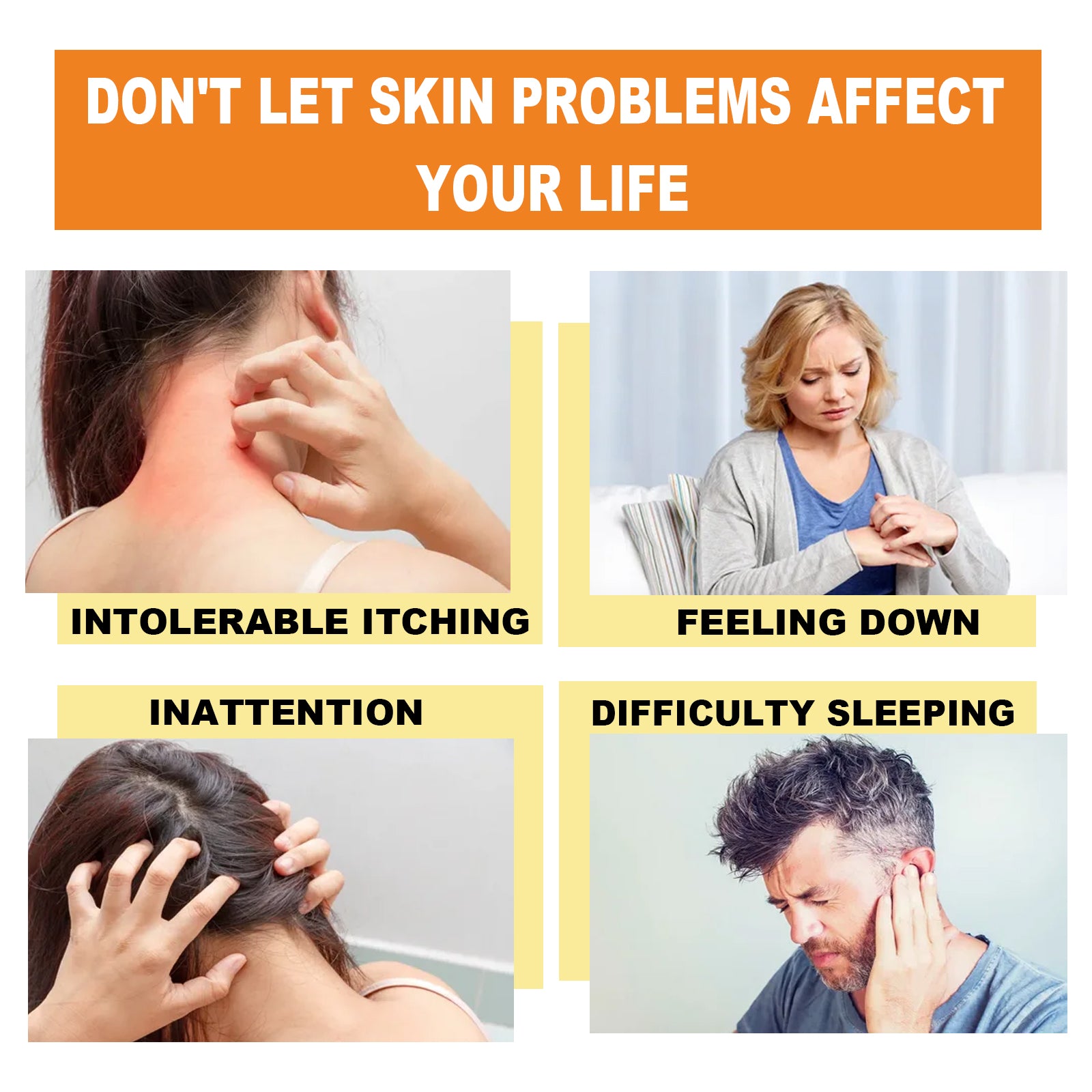 Bee Venom Psoriasis Cream, Relieve Itchy Skin Repair Hand Moss Moisturizing Skin Care Cream Health Eprolo https://www.cyberehub.com