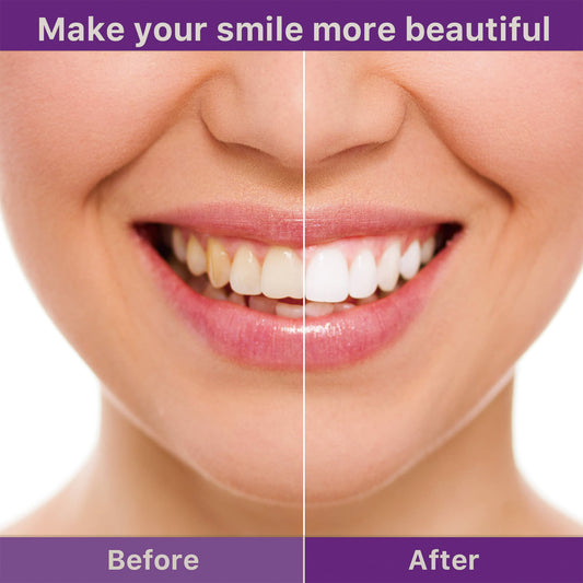 Tooth Cleaning Mousse, Anti-Decay Clean Teeth Tartar Breath Fresh Whitening Teeth Toothpaste Health Eprolo https://www.cyberehub.com