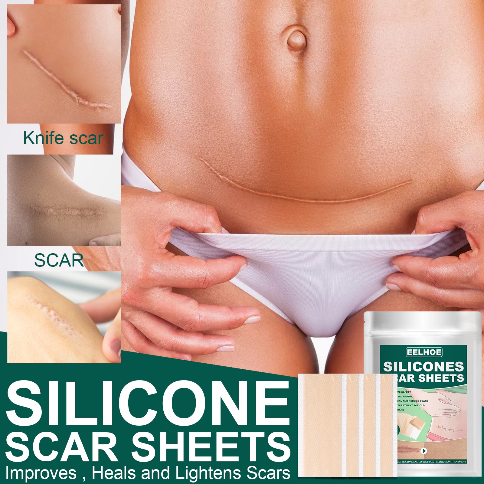 Silicone Gel Repair Patch, Fade Marks Transparent Care Skin Repair Patch Health Eprolo https://www.cyberehub.com