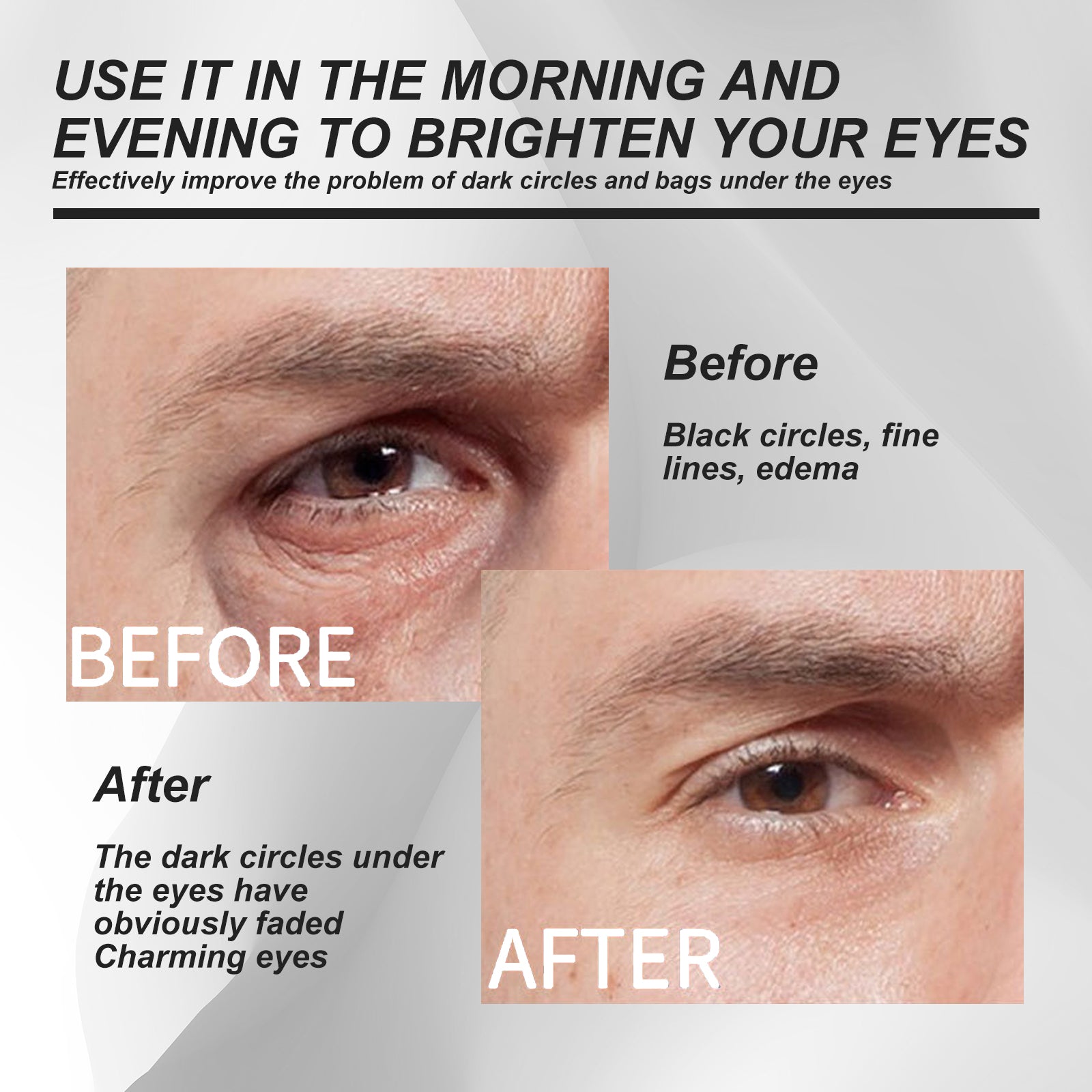 Men's Eye Cream, Reduces Eye Bags Dark Circles Fine Lines Firming Skin And Moisturizing Eye Cream Health Eprolo https://www.cyberehub.com