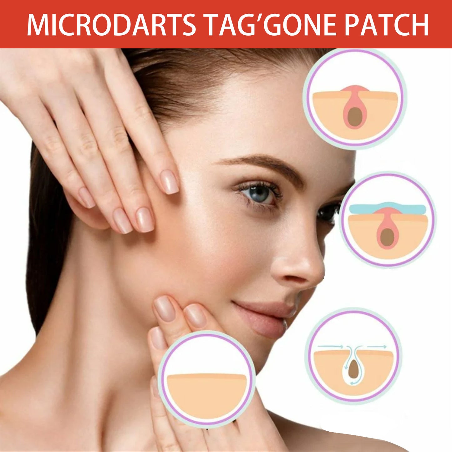 Acne Patch, Skin Clean Acne Pimple Moles Gram Wart Corns Spot Patch Health Eprolo https://www.cyberehub.com