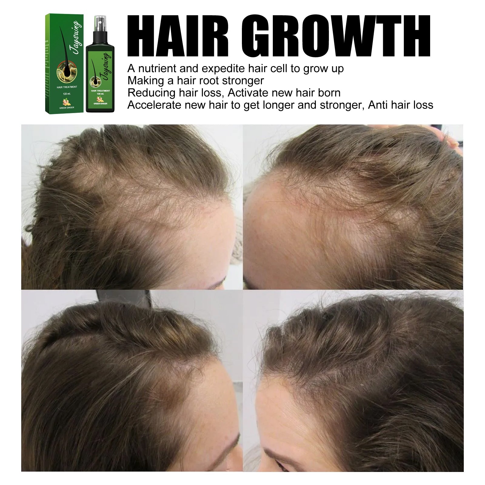 Hair Care Solution Gently Nourishes And Massages Scalp, Moisturizes And Softens Hair Care Spray Health Eprolo https://www.cyberehub.com