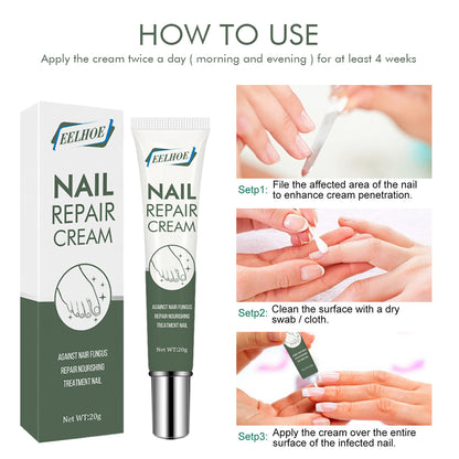 Foot Care And Thickening Nail Repair Cream. Nail Repair Cream Health Eprolo https://www.cyberehub.com