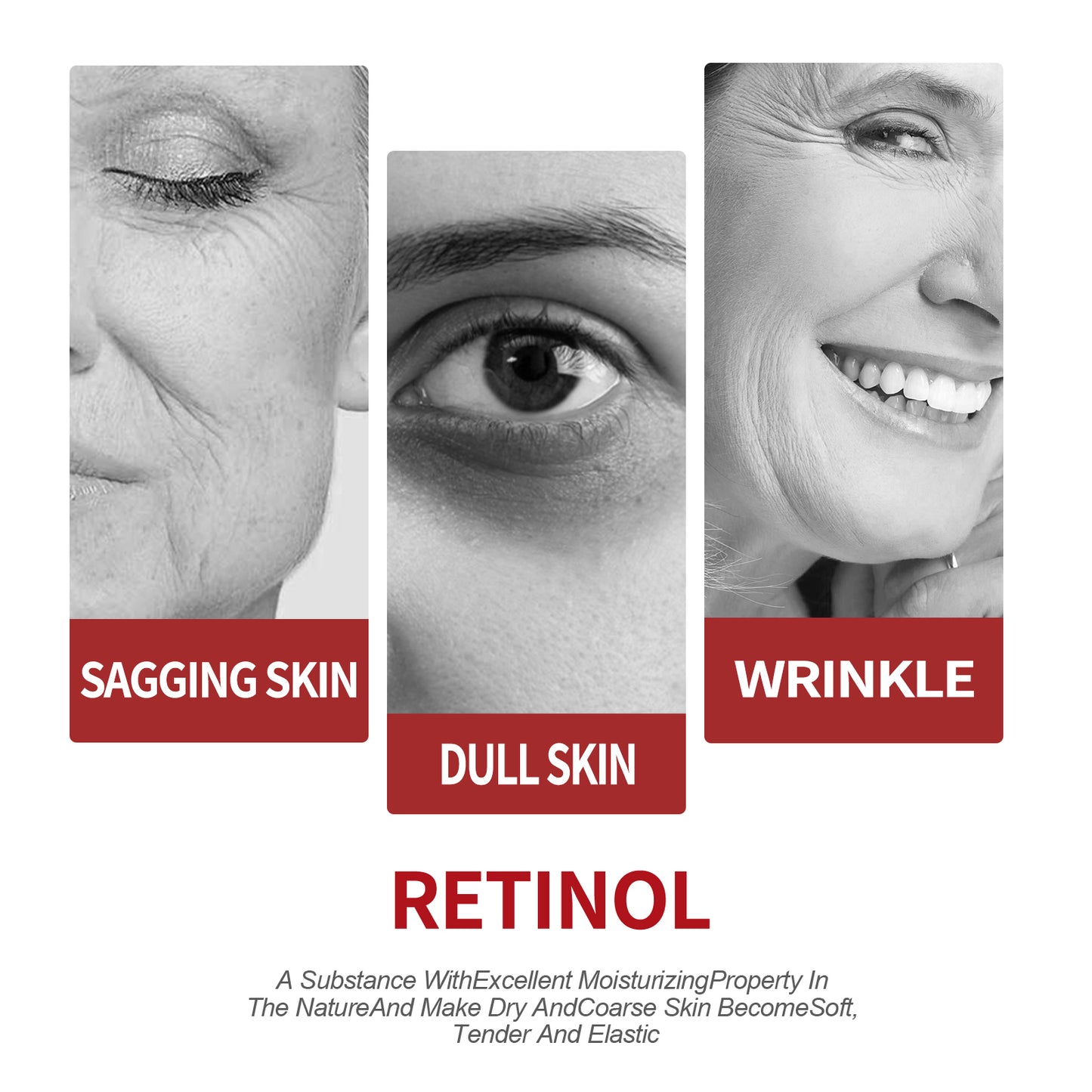 OUHOE Retinol Moisturizing Cream To Reduce Fine Lines, Dark Circles, Moisturize, Tighten Pores And Prevent Aging Health Eprolo https://www.cyberehub.com