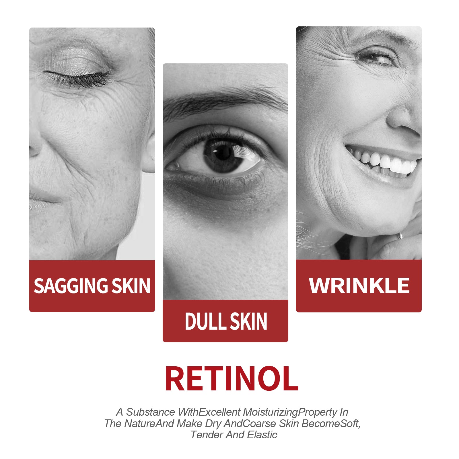 OUHOE Retinol Moisturizing Cream To Reduce Fine Lines, Dark Circles, Moisturize, Tighten Pores And Prevent Aging Health Eprolo https://www.cyberehub.com