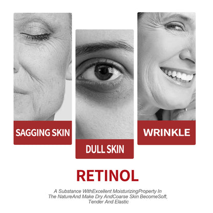OUHOE Retinol Moisturizing Cream To Reduce Fine Lines, Dark Circles, Moisturize, Tighten Pores And Prevent Aging Health Eprolo https://www.cyberehub.com