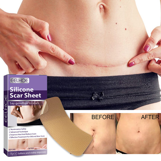 Silicone Scar Patch, Reduces Stretch Marks And Hyperplasia Of Caesarean Section Scars Silicone Patch Health Eprolo https://www.cyberehub.com