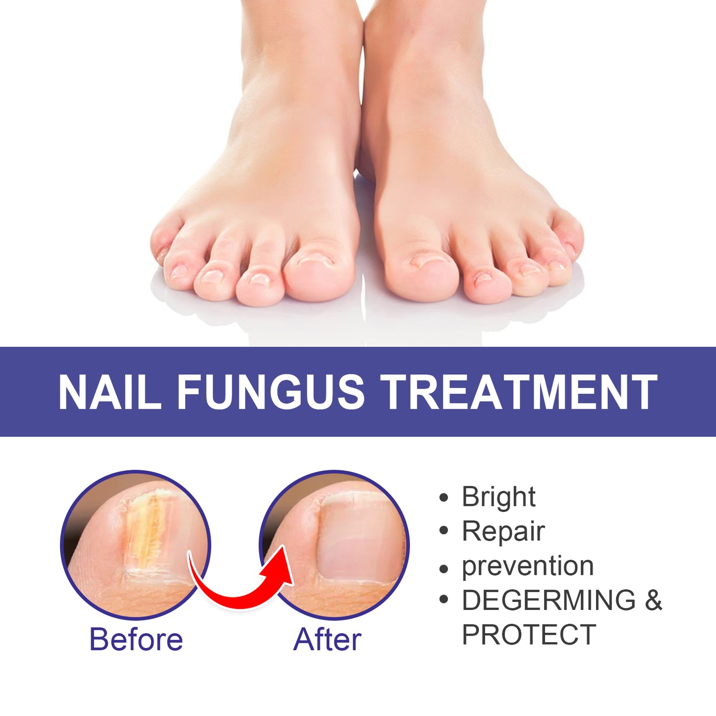 Nail Repair Lotion, Repair Thickening Nail Inlay Gray Nail Shine Soft Nail Care Solution Health Eprolo https://www.cyberehub.com