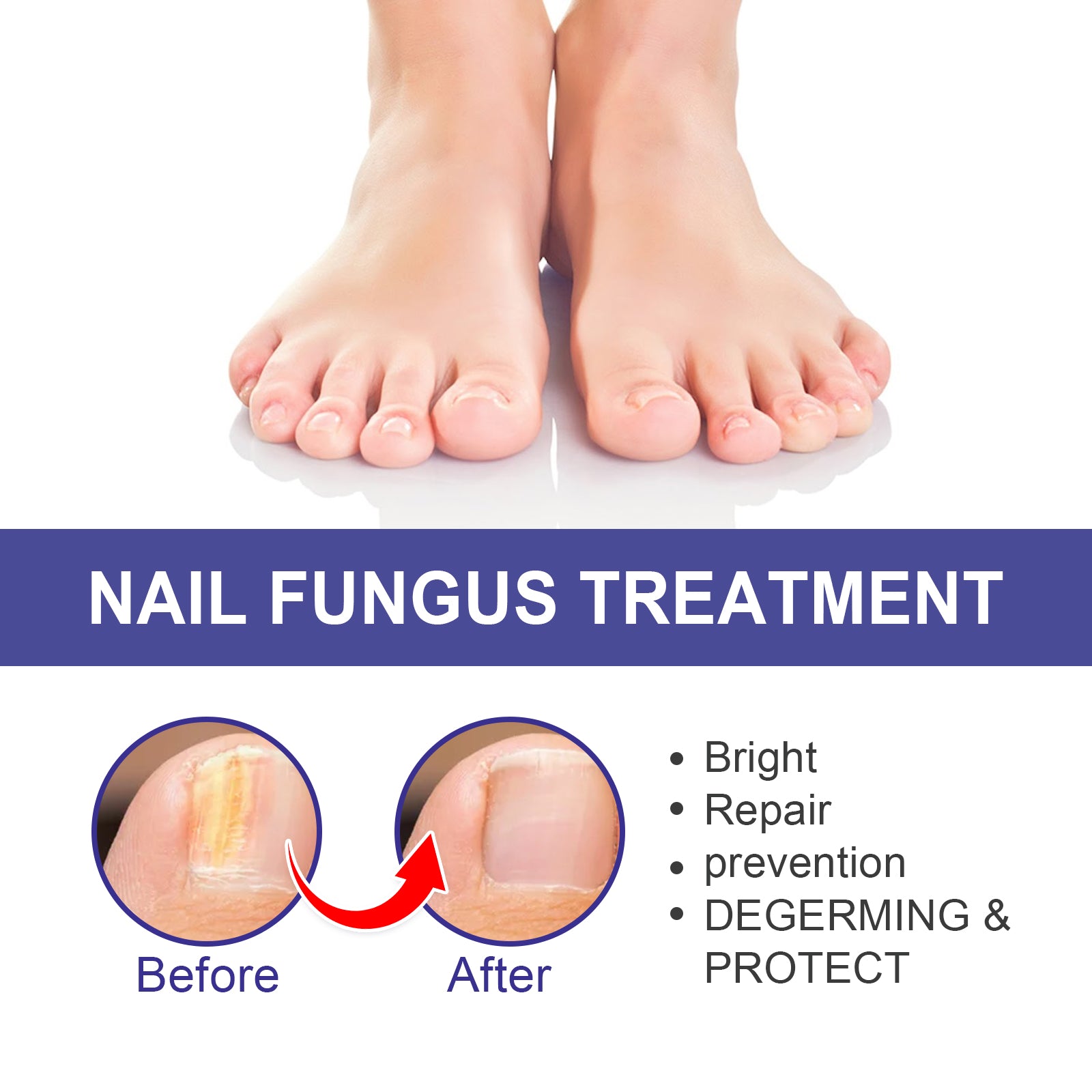 Nail Repair Lotion, Repair Thickening Nail Inlay Gray Nail Shine Soft Nail Care Solution Health Eprolo https://www.cyberehub.com