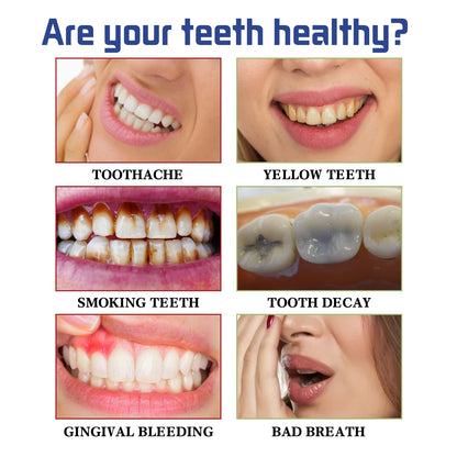 Tooth Cleaning Mousse, Mouth Clean Fresh Bright White Anti-decay Foam Toothpaste Health Eprolo https://www.cyberehub.com
