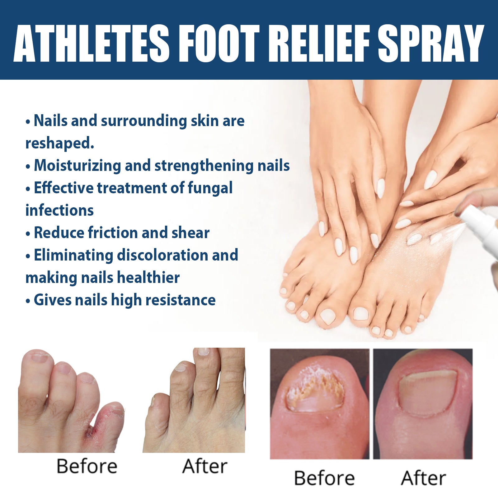 Athletes Foot Relief Spray, Relieve Foot Sweat Foot Itching Peeling Gray Nails Foot Odor Moisturizing Care Spray Health Eprolo https://www.cyberehub.com