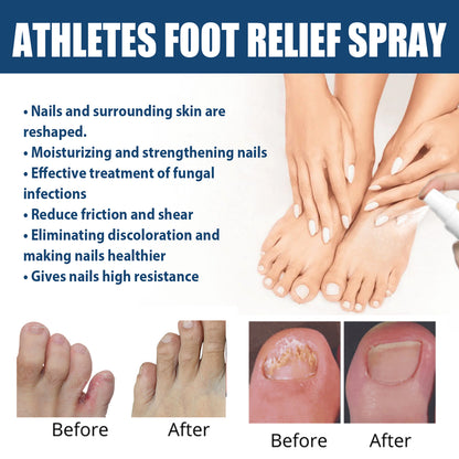 Athletes Foot Relief Spray, Relieve Foot Sweat Foot Itching Peeling Gray Nails Foot Odor Moisturizing Care Spray Health Eprolo https://www.cyberehub.com