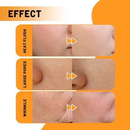Face Essence Reduces Fine Lines, Brightening Facial Tone, Moisturizing And Hydrating Skin Essence Health Eprolo https://www.cyberehub.com