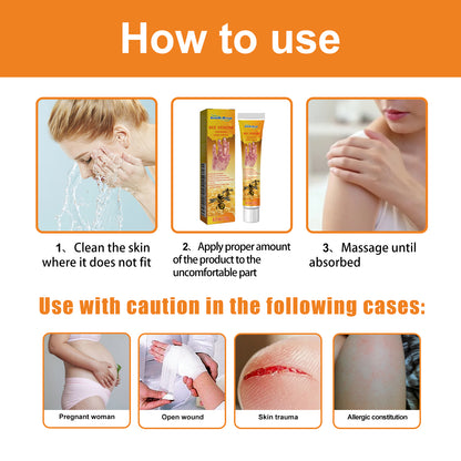 Bee Venom Psoriasis Cream, Relieve Itchy Skin Repair Hand Moss Moisturizing Skin Care Cream Health Eprolo https://www.cyberehub.com
