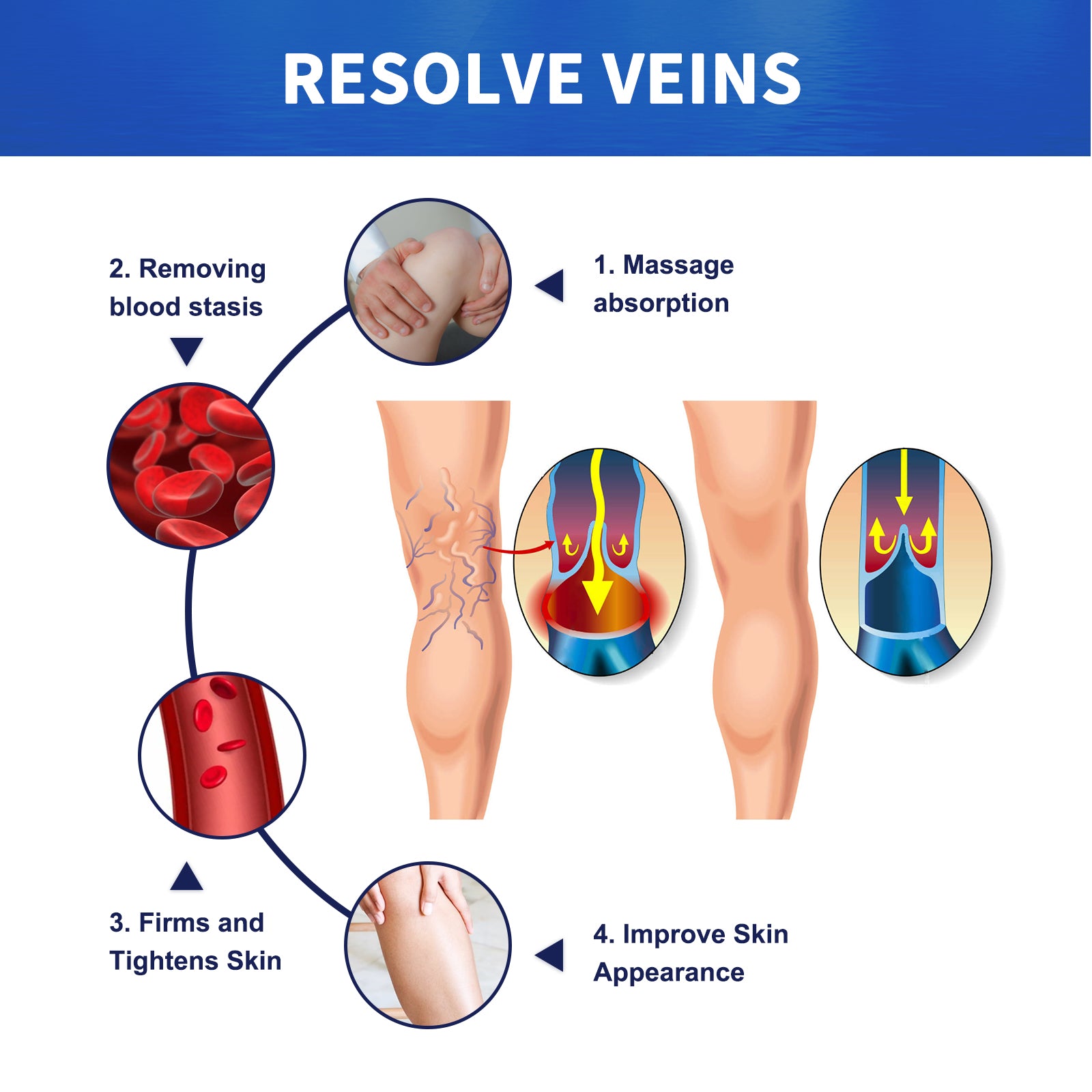 Vein Massage Varicose Cream Repair Earthworm Legs To Relieve Leg Blood Vessel Bulge And Varicoidea Health Eprolo https://www.cyberehub.com
