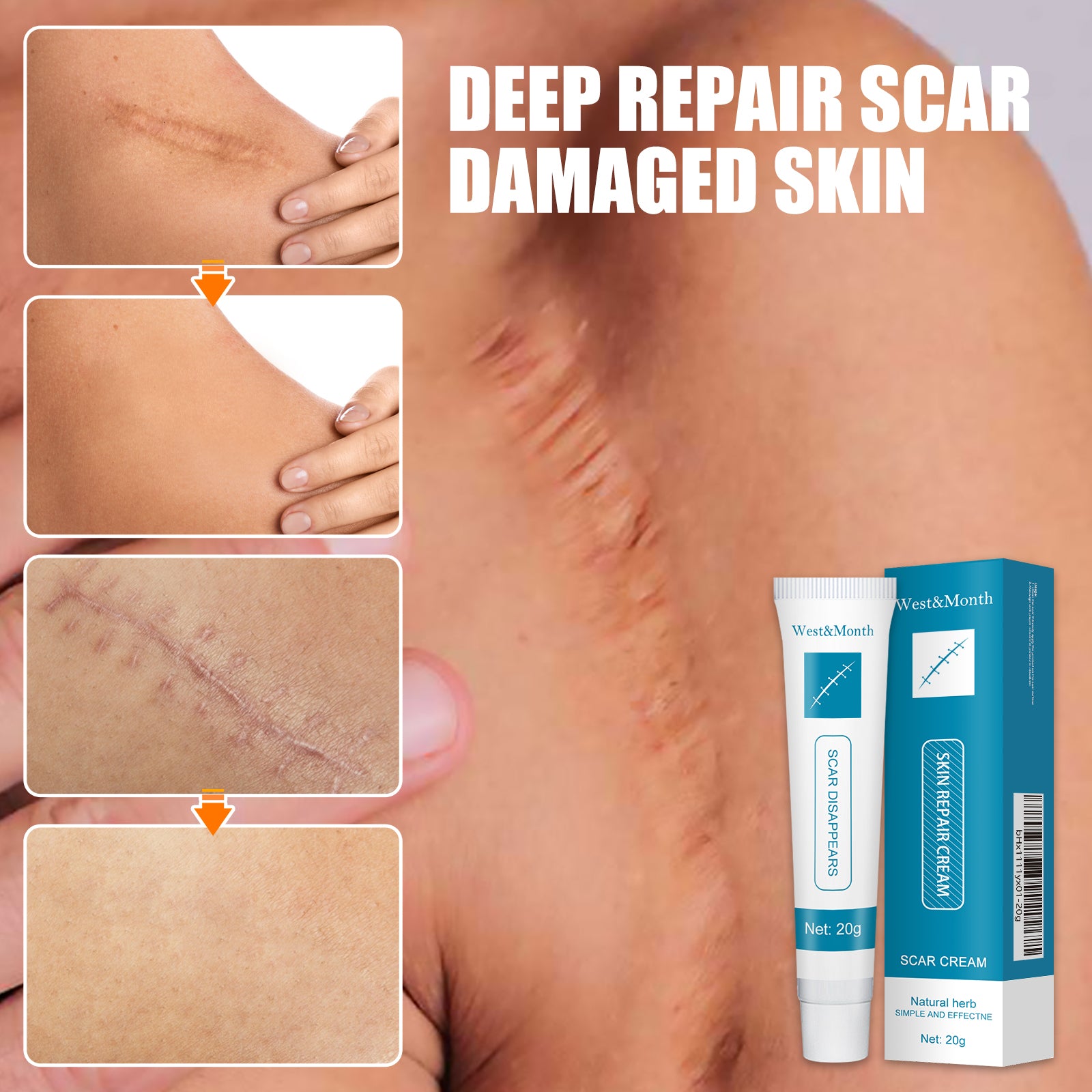 Skin Repair Cream Gentle Moisturizing Hydrating Moisturizing Repair Skin Care Repair Cream Health & Beauty Health Eprolo https://www.cyberehub.com