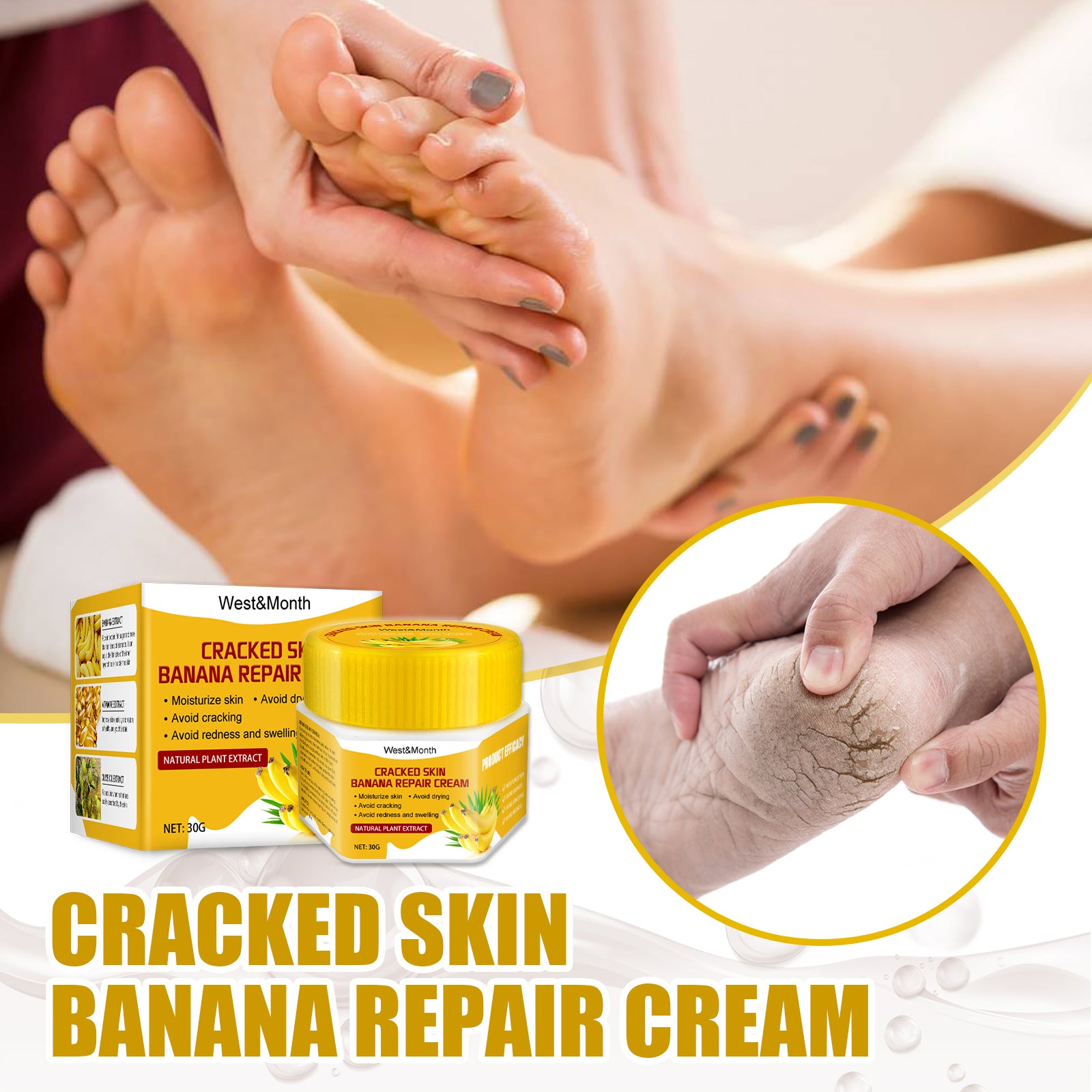 Cracked Skin Banana Repair Cream, Nourishing And Moisturizing Foot Repair Cream To Soften Exfoliation And Remove Dead Skin Calluses Health Eprolo https://www.cyberehub.com