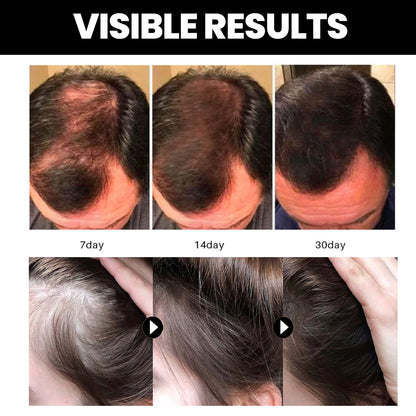 Batana Essential Oil, Hair Smoothing Anti-Loss Nourishing Skin Care Essential Oil Health Eprolo https://www.cyberehub.com