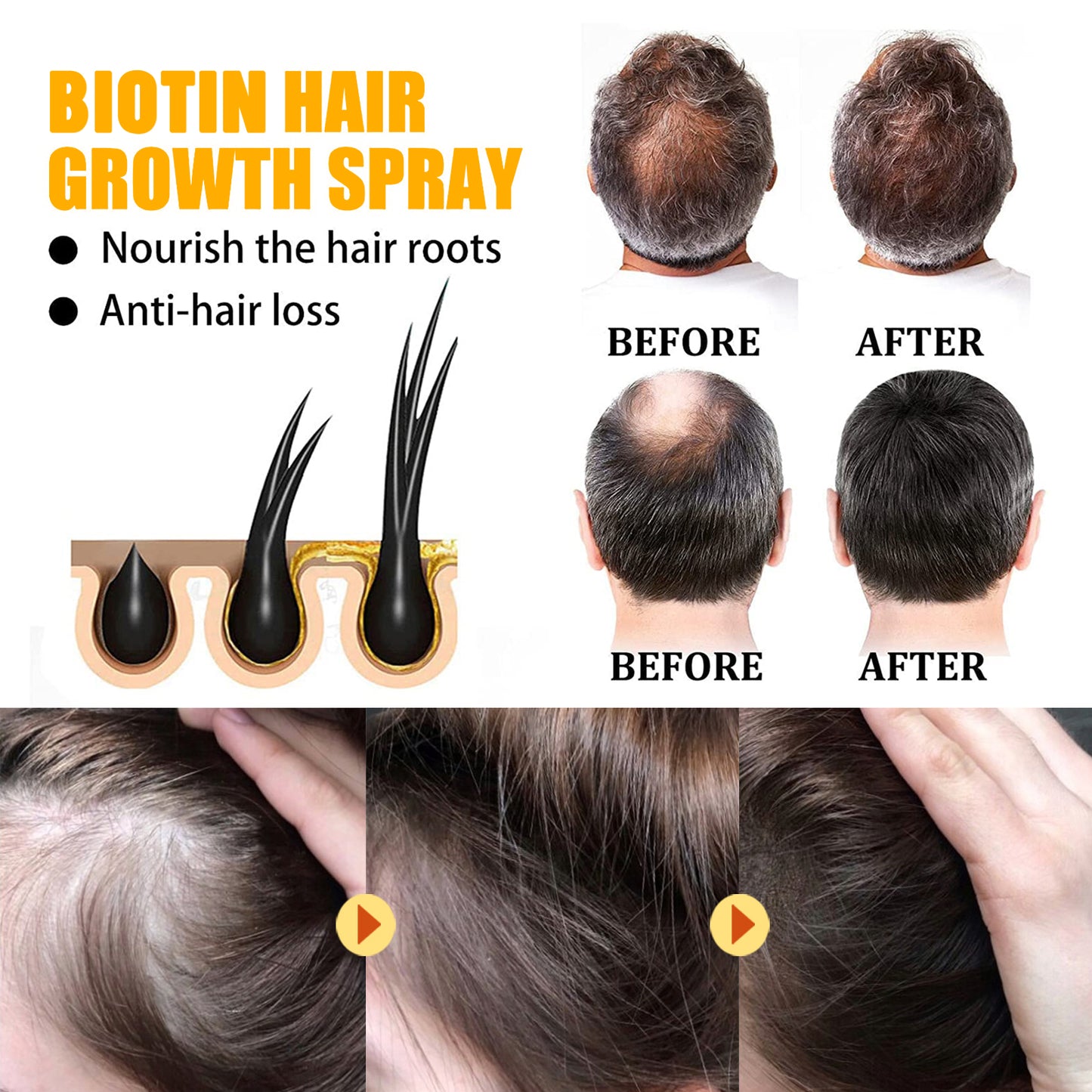 Biotin Hair Essential Oil Deeply Moisturizes And Improves Scalp Massage Treatment Soft Hair Essential Oil Health & Beauty Health Eprolo https://www.cyberehub.com