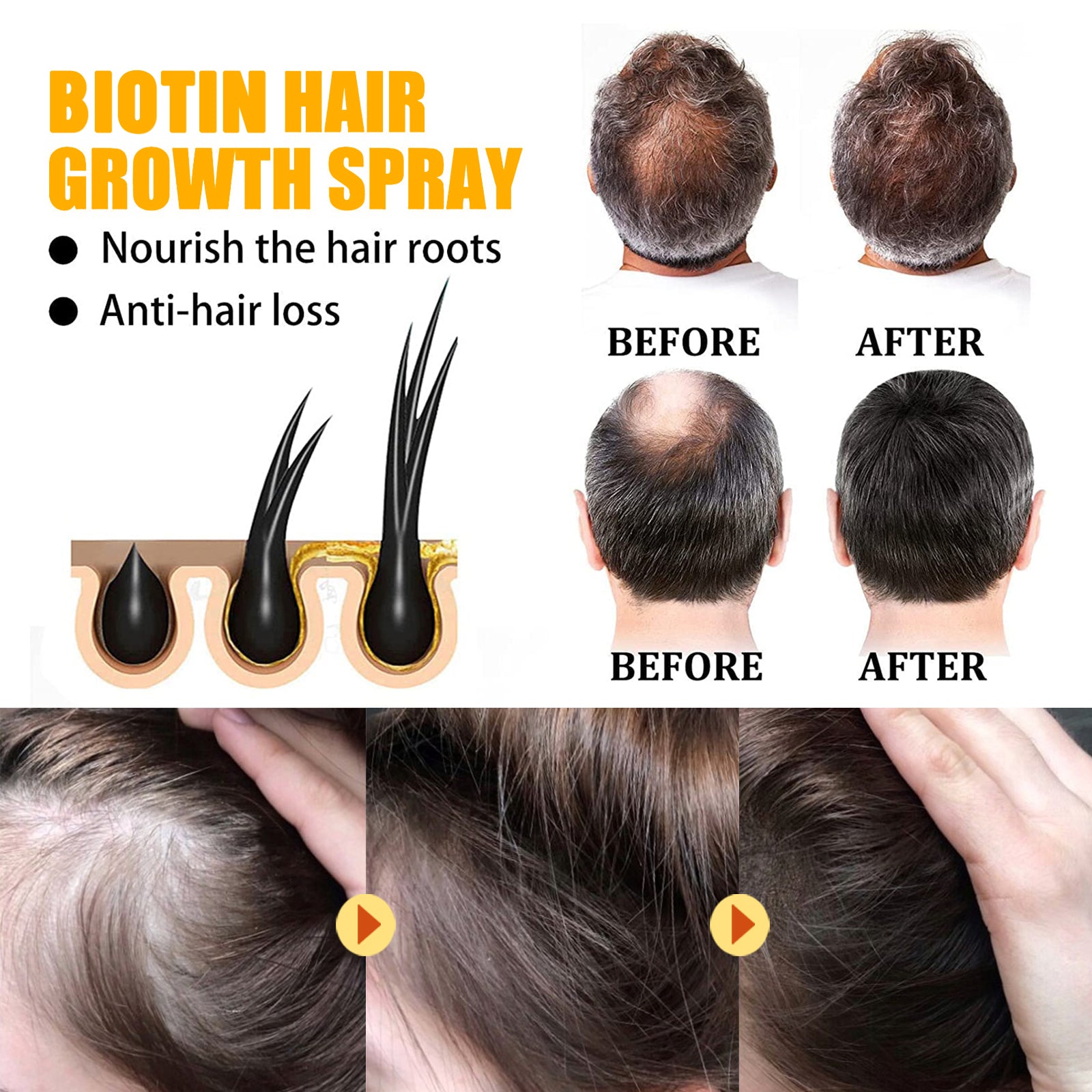 Biotin Hair Essential Oil Deeply Moisturizes And Improves Scalp Massage Treatment Soft Hair Essential Oil Health & Beauty Health Eprolo https://www.cyberehub.com