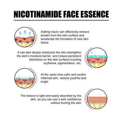 Nicotinic Acid Face Essence Lighten Acne Marks, Moisturize Pores, Shrink And Whiten Skin Beauty Essence Health Eprolo https://www.cyberehub.com
