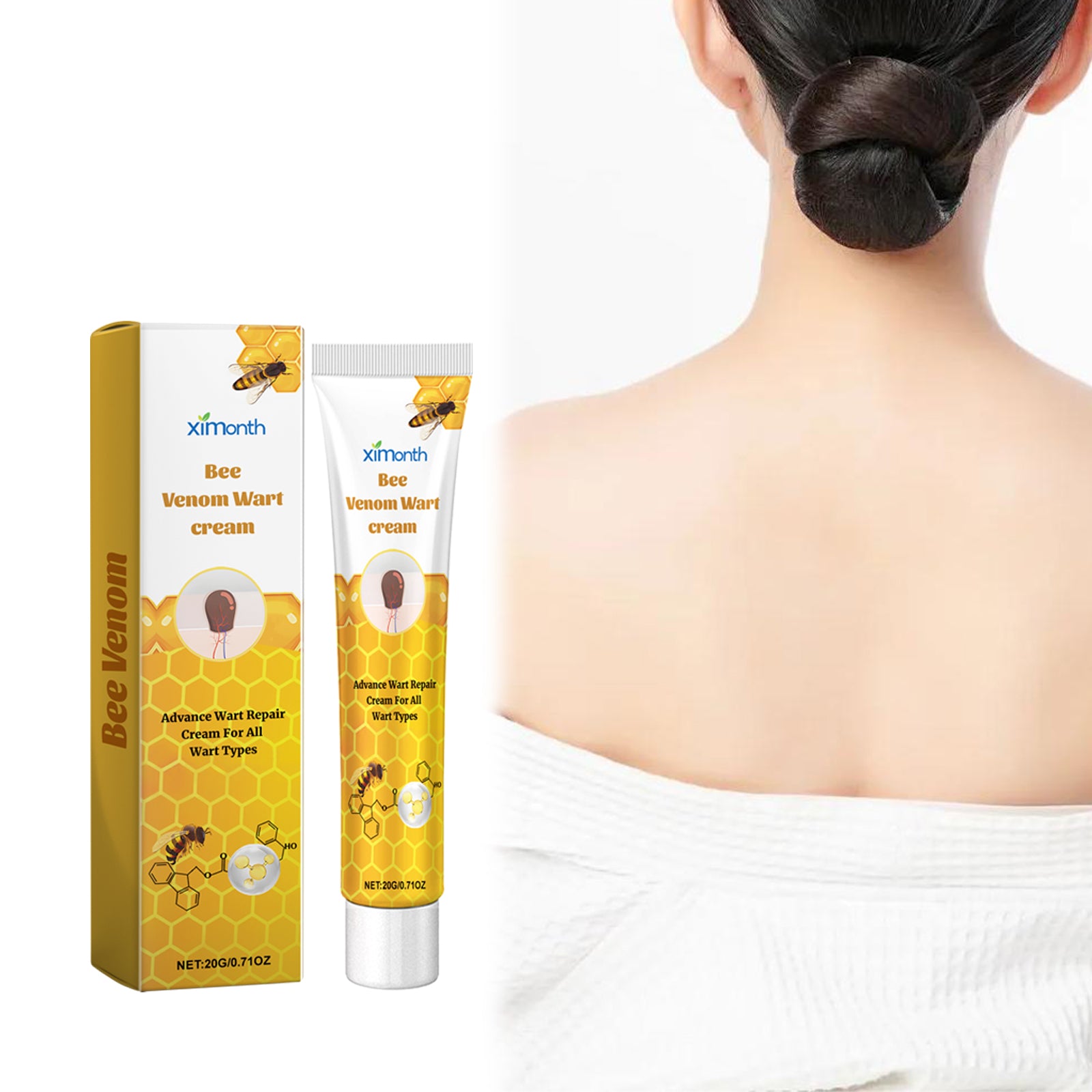 Ximonth Bee Venom Wart Cream, Repair Smooth Skin Lightening Nevus Spot Nevus Cure Wart Care Cream Health Eprolo https://www.cyberehub.com