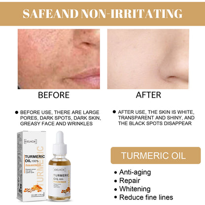 EELHOE Turmeric Correction Essence Facial Care Hydrating Moisturizing Gentle Moisturizing Skin Care Essence Health Eprolo https://www.cyberehub.com