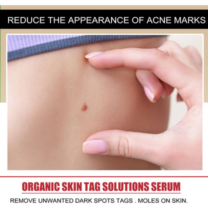 ELHOE Face Essence Gently Cleanses Facial Skin Moisturizing, Moisturizing, Smoothing And Brightening Skin Care Essence Health Eprolo https://www.cyberehub.com