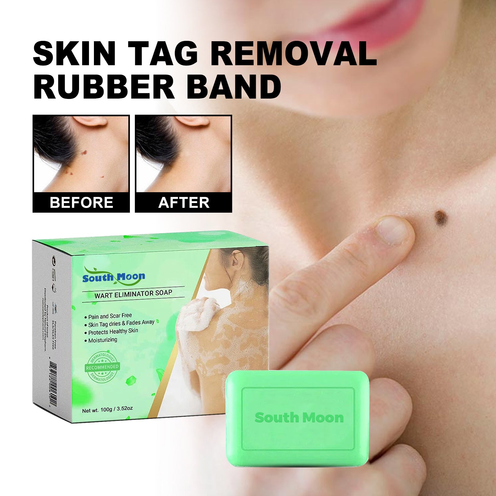 Skin Tag Removal Rubber Band, Remove Moles Remove Warts Face Neck Flesh Granule Body Cleansing Soap default title Health Eprolo https://www.cyberehub.com