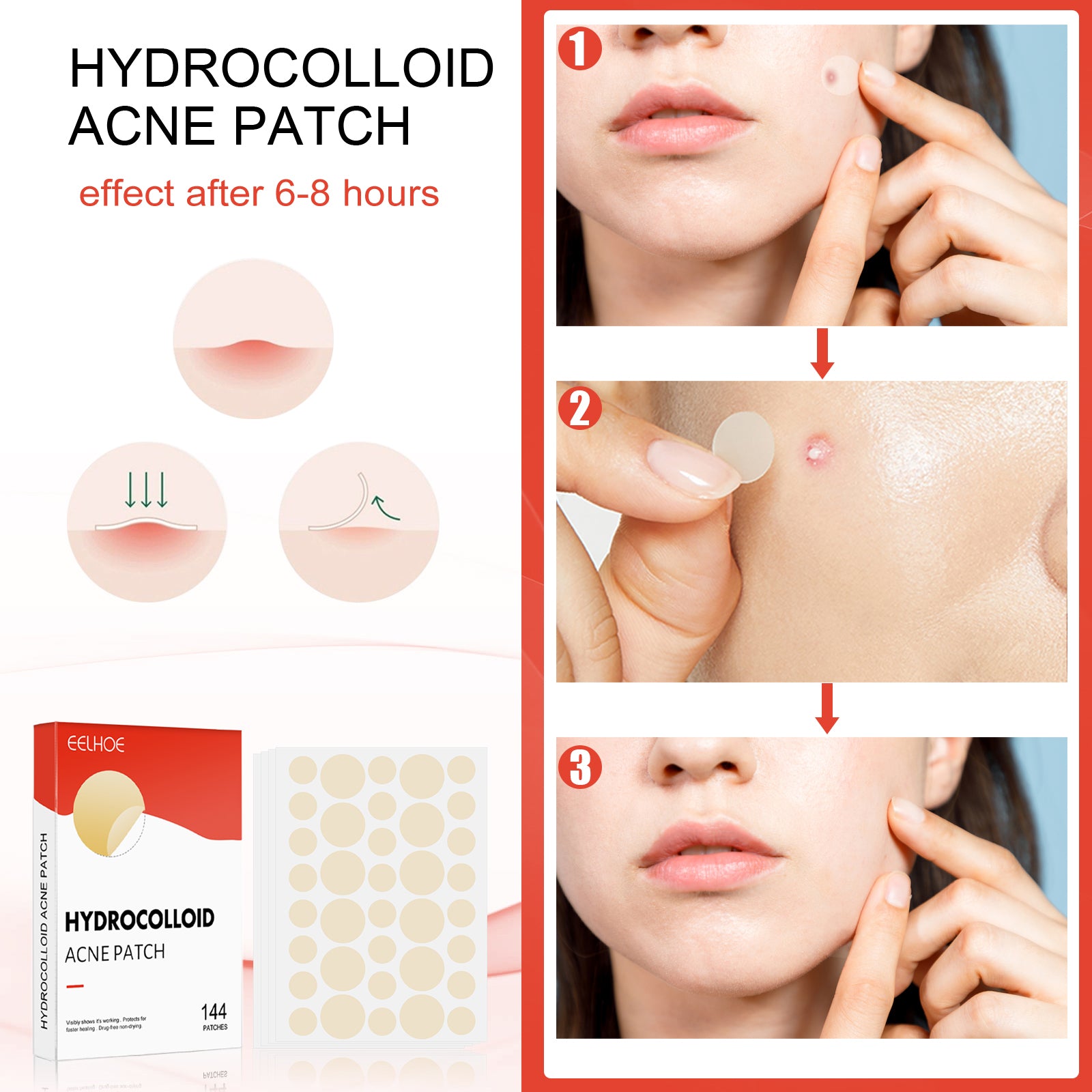 Hydrocolloid Acne Patch Face Invisible Makeup Closed Mouth Acne Clear Acne Waterproof Breathable Facial Treatment Health Eprolo https://www.cyberehub.com