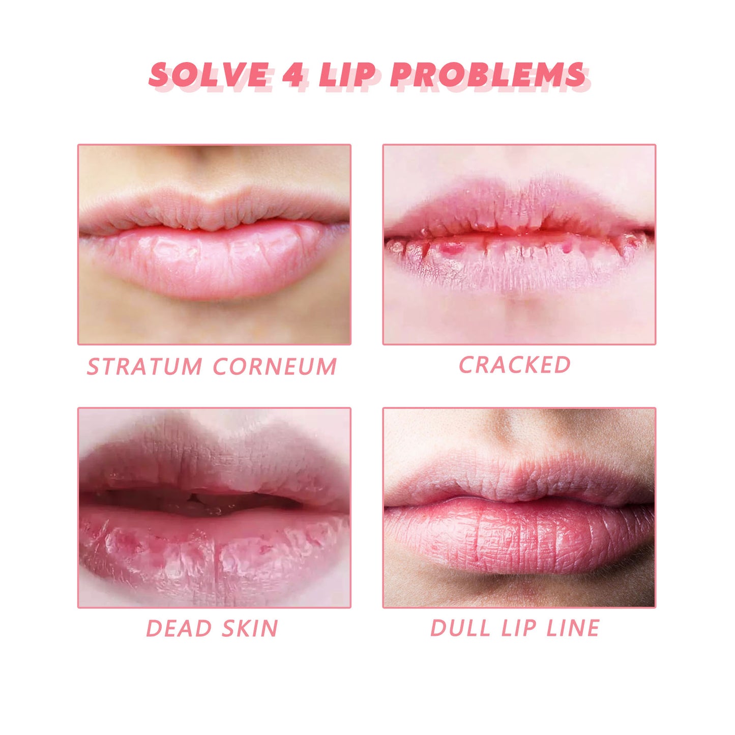 Peach Lip Scrub Moisturizes The Lips, Hydrates The Lips, Lightens The Skin Around The Lips And Improves The Corners Of The Mouth Health Eprolo https://www.cyberehub.com