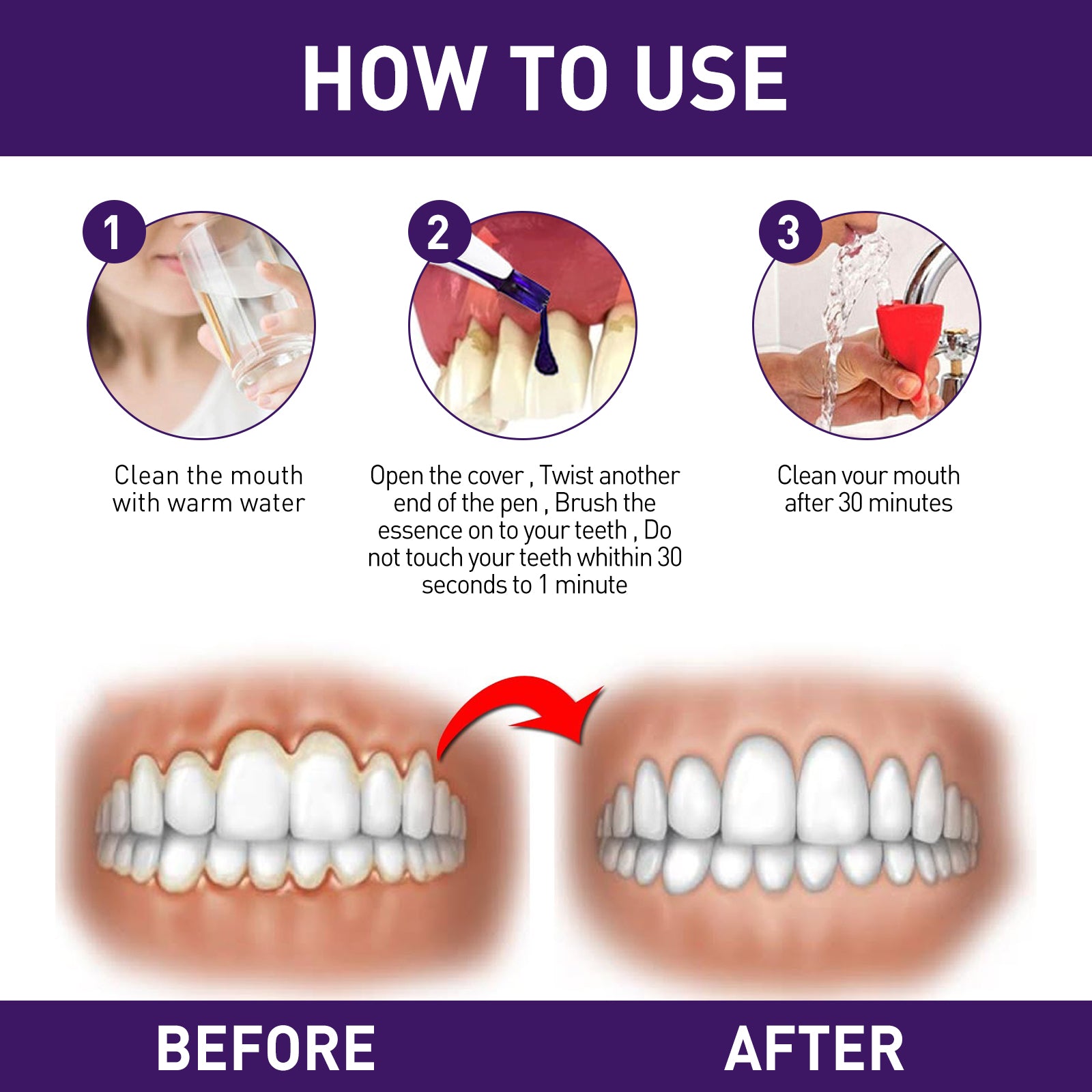 Gum Corrector Pen, Teeth Cleaning Whitening Brightening Repair Gum Teeth Beauty Pen Health Eprolo https://www.cyberehub.com