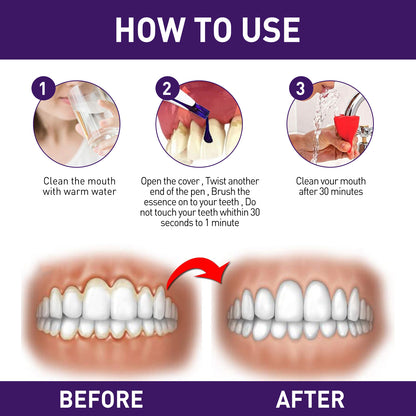 Gum Corrector Pen, Teeth Cleaning Whitening Brightening Repair Gum Teeth Beauty Pen Health Eprolo https://www.cyberehub.com