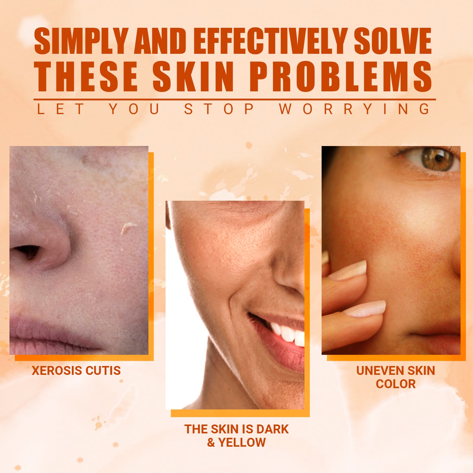 Vitamin C Moisturizing Spray Hydrates And Moisturizes Skin, Lightening Acne Spots And Whitening Spray Health Eprolo https://www.cyberehub.com