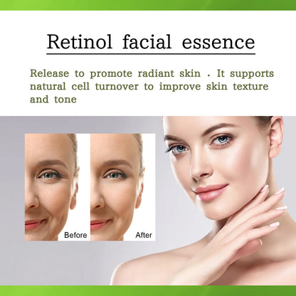 Retinol Serum, Face Anti-Wrinkle Firming Brightening Soft And Smooth Skin Serum Health Eprolo https://www.cyberehub.com