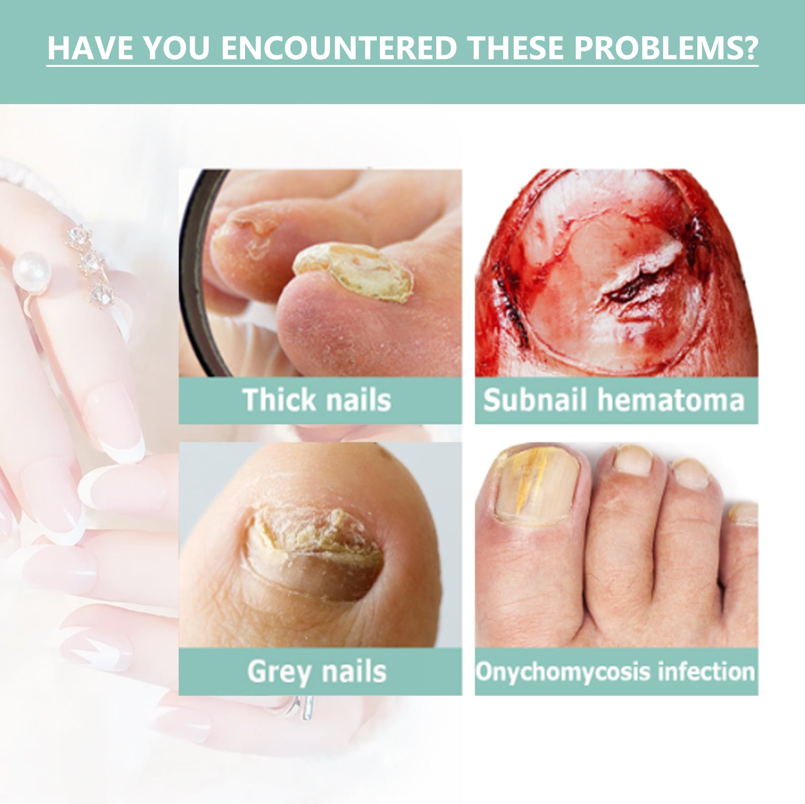 Nail Repair Pen Hand And Foot Gray Nails Cleaning Soft Nails Rotten Nails Thickening Nails Shining Nails Treatment Health Eprolo https://www.cyberehub.com