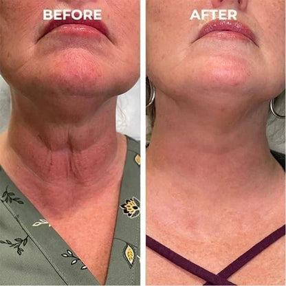 EELHOE Facial Essence, Lifts And Tightens Facial Skin And Reduces Fine Lines And Wrinkles Health Eprolo https://www.cyberehub.com