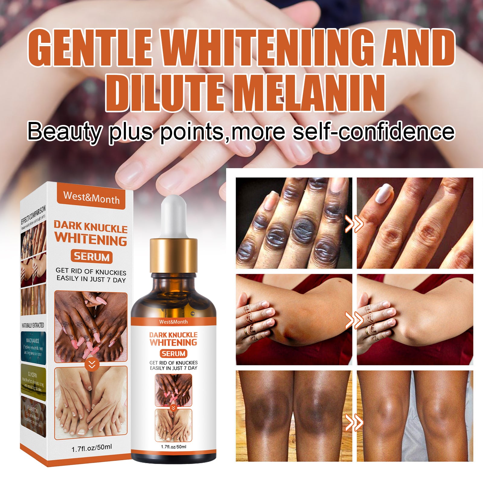 Skin Blackening Essence Brightening Knee Ankle Horn Melanin Removing Moisturizing Essence Health & Beauty Health Eprolo https://www.cyberehub.com