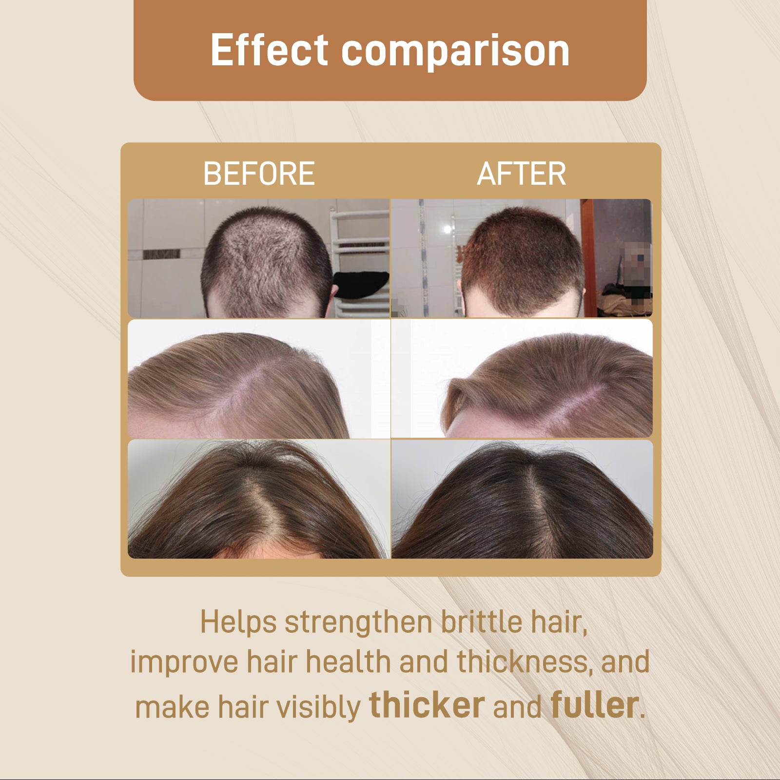 Googeer Dense Hair Dietary Supplement Drops Nourishes Roots, Prevents Breakouts And Strengthens Hair Care Supplements Health Eprolo https://www.cyberehub.com