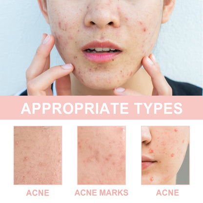 Acne Patch, Repair Acne Pimple Facial Redness Clean Pores Moisturize Skin Patch Health Eprolo https://www.cyberehub.com