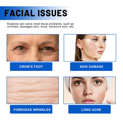 Blueberry Facial, Care Facial Skin Deep Cleansing Anti-Wrinkle Skin Care Essence Beauty Brightening Cream Health & Beauty Health Eprolo https://www.cyberehub.com