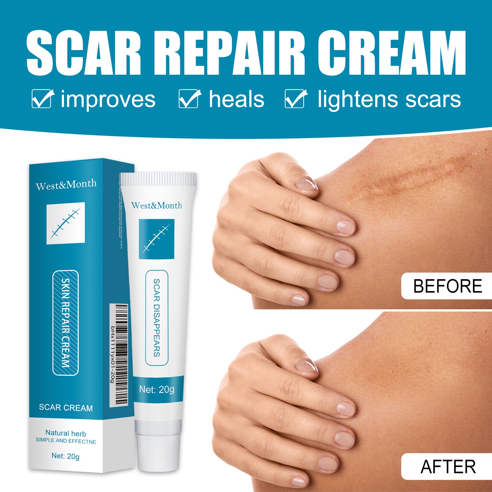 Skin Repair Cream Gentle Moisturizing Hydrating Moisturizing Repair Skin Care Repair Cream Health & Beauty Health Eprolo https://www.cyberehub.com
