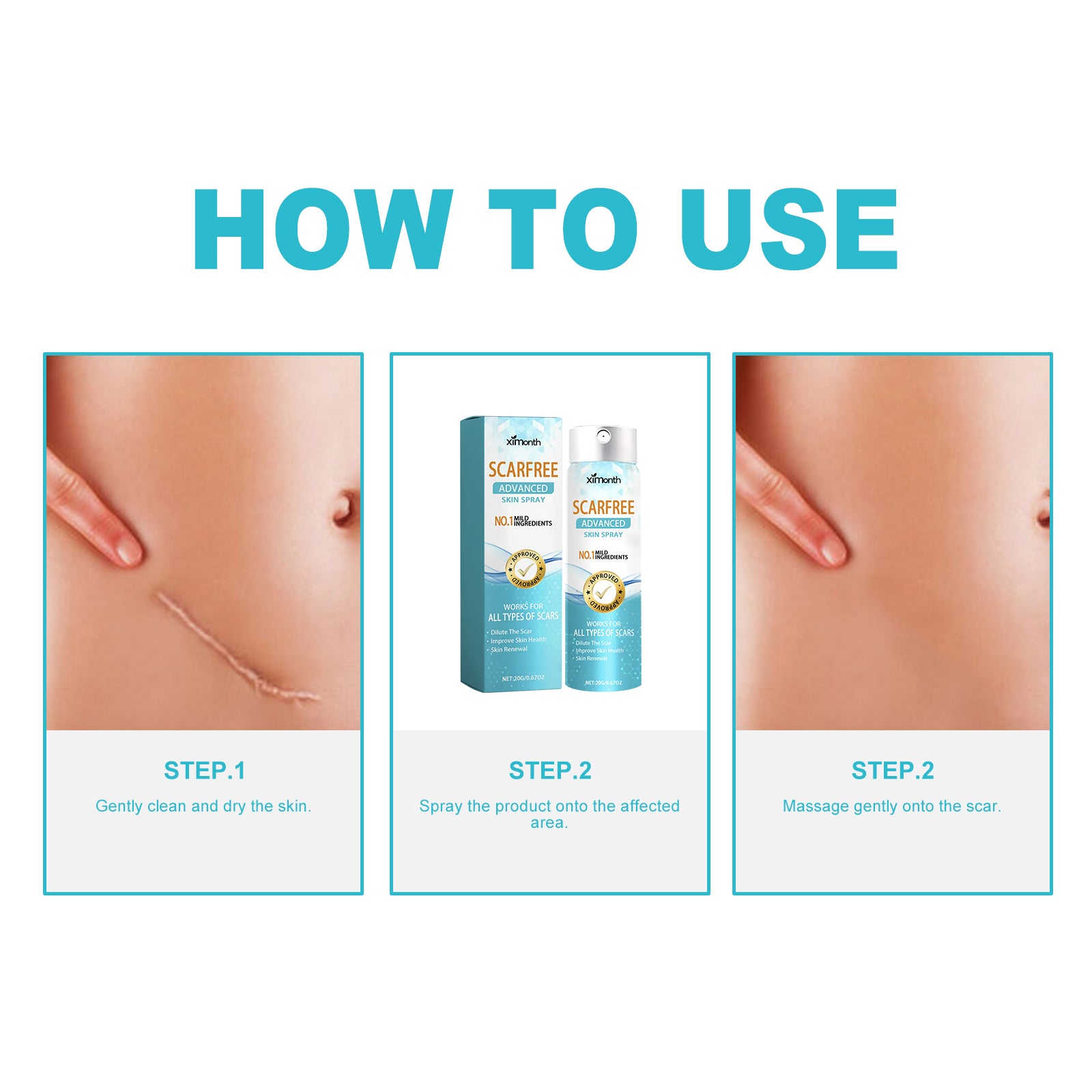 Scarfree Advanced Skin Spray, Body Skin Care Reduces Post-Natal Scars And Smooths Skin Health & Beauty Health Eprolo https://www.cyberehub.com