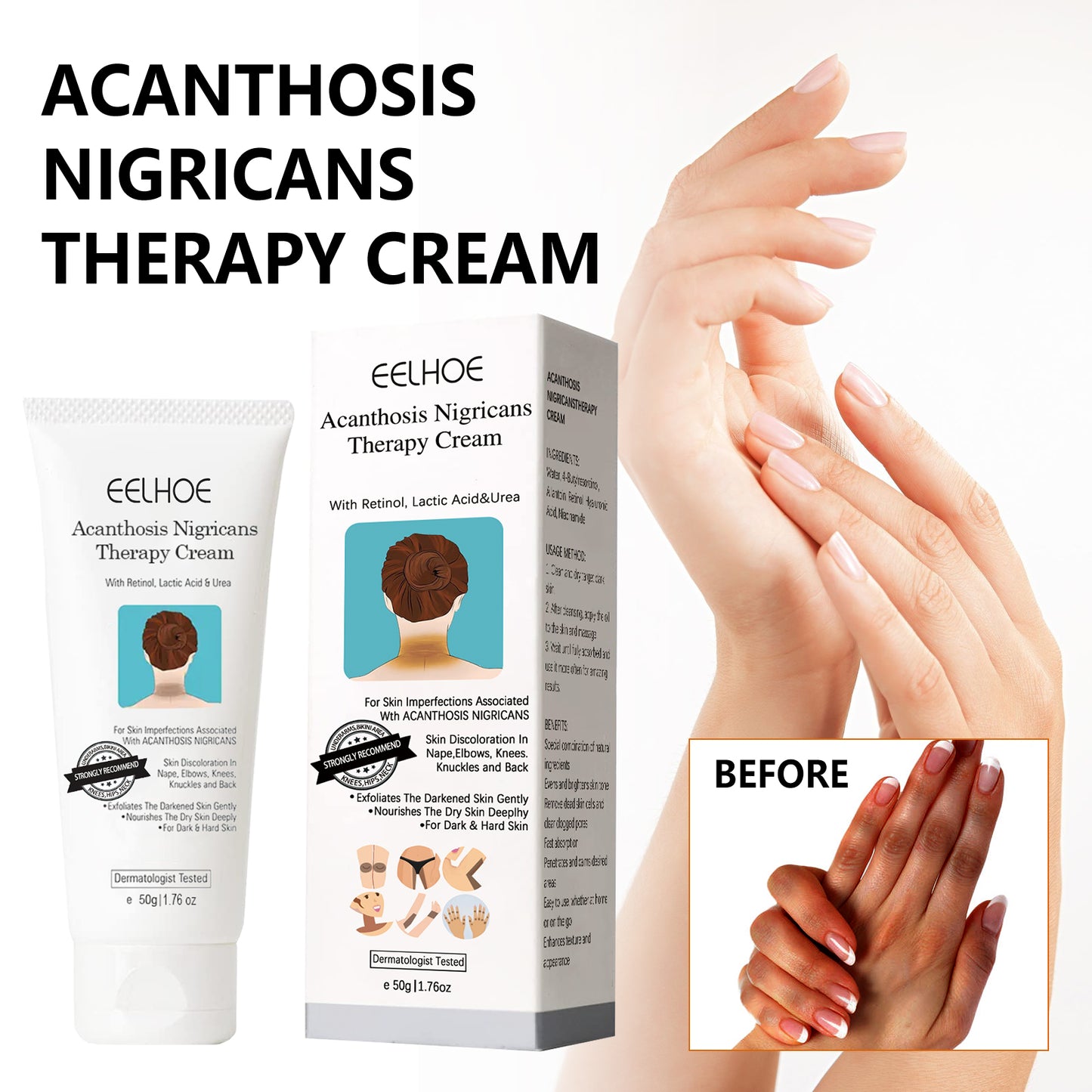 Black Acanthoderm Repair Cream Repair Underarm Arm Knee Joint Black Moisturizing Whitening Body Care Cream Health Eprolo https://www.cyberehub.com