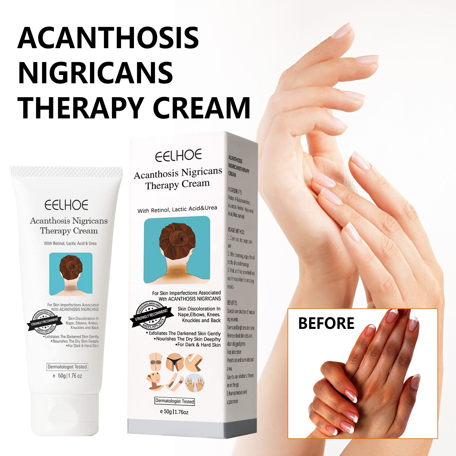 Black Acanthoderm Repair Cream Repair Underarm Arm Knee Joint Black Moisturizing Whitening Body Care Cream Health Eprolo https://www.cyberehub.com