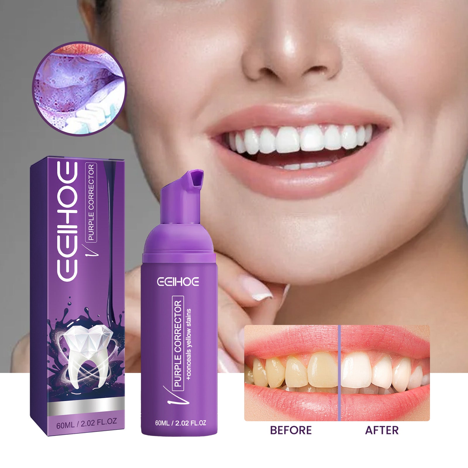 Purple Corrector, Deeply Clean Tartar Very Well Tartar Yellow Teeth Care For Oral Health Care Health Eprolo https://www.cyberehub.com