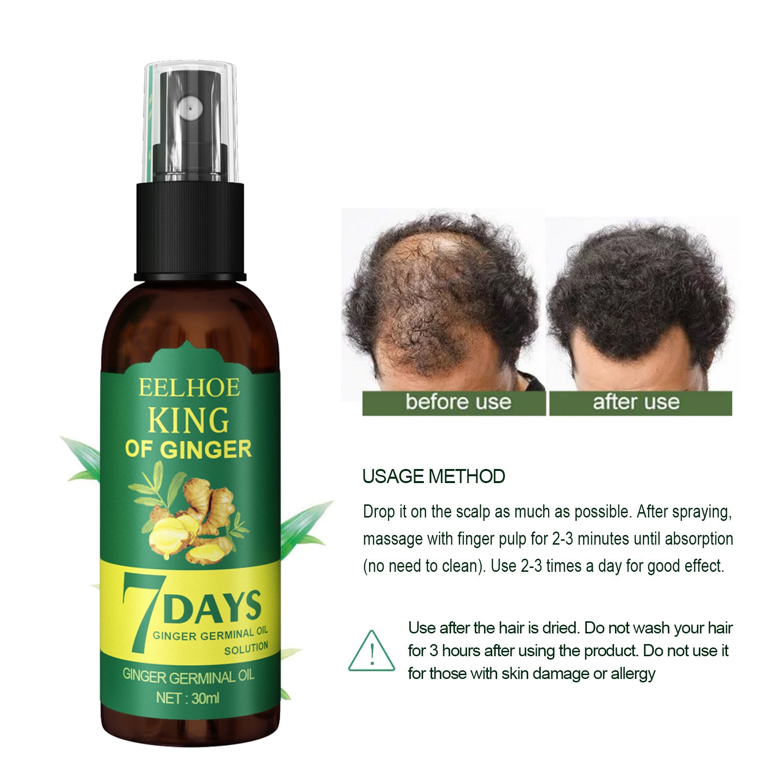 EEL Ginger Hair Spray, Strengthens Hair, Massages Scalp And Restores Hair Health Eprolo https://www.cyberehub.com