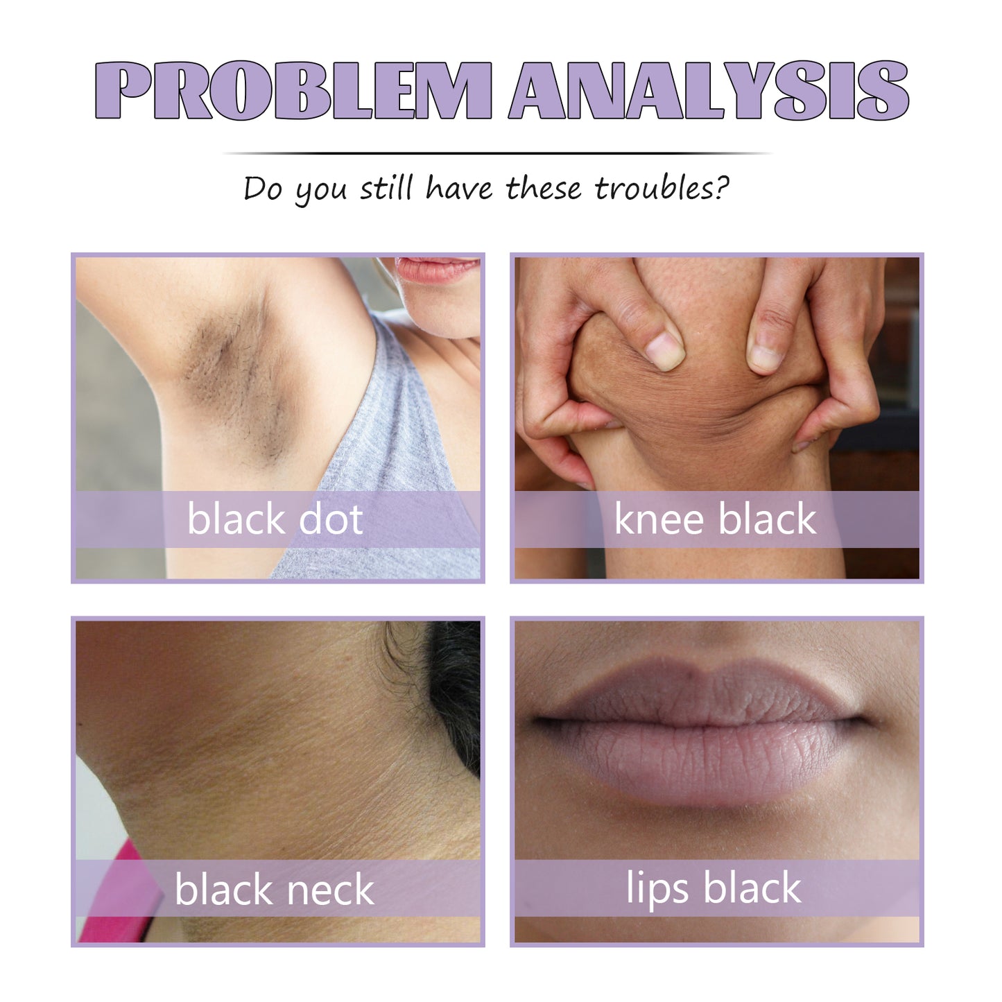 Dark Spot Repair Cream, Lightens Dark Spots Moisturizes Skin Delicate And Brightening Body Lotion Health Eprolo https://www.cyberehub.com