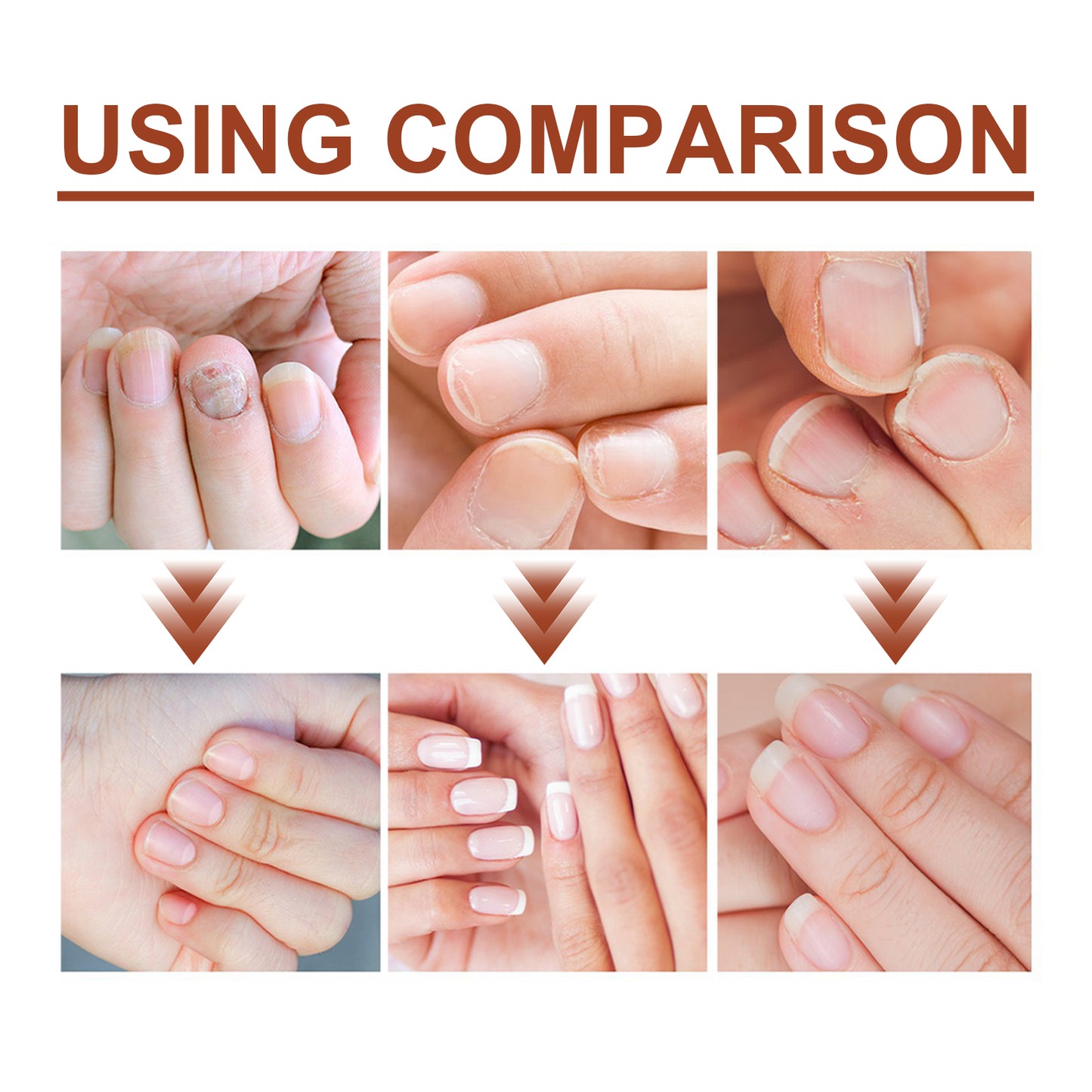 Jaysuing 7 Day Nail Care Essence Grey Nail, Hand, Foot And Nail Nourishing Cleansing Essence Health Eprolo https://www.cyberehub.com