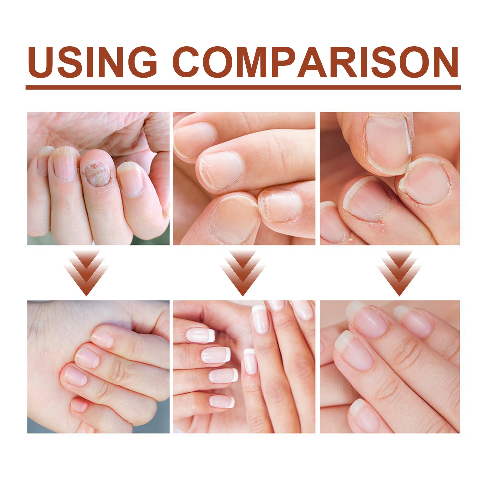 Jaysuing 7 Day Nail Care Essence Grey Nail, Hand, Foot And Nail Nourishing Cleansing Essence Health Eprolo https://www.cyberehub.com